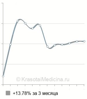 Средняя стоимость рентген лучезапястного сустава в Новосибирске