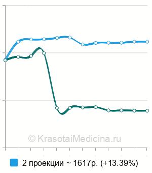 Средняя стоимость рентген предплечья в Новосибирске