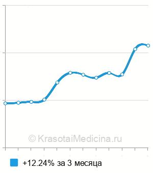 Средняя стоимость МРТ кисти в Новосибирске