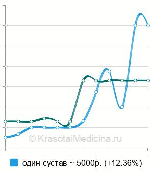 Средняя стоимость МРТ локтевого сустава в Новосибирске