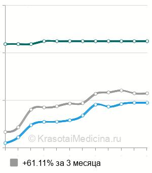 Средняя стоимость МРТ мягких тканей шеи в Новосибирске