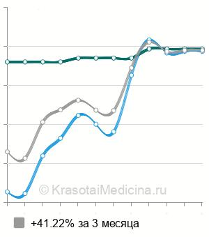 Средняя стоимость МРТ мягких тканей (1 локализация) в Новосибирске