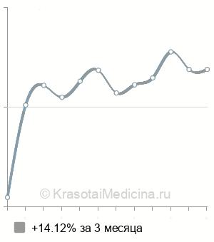 Средняя стоимость гистеросальпингография (ГСГ) в Новосибирске