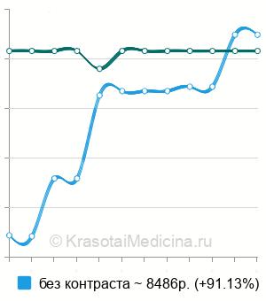 Средняя стоимость КТ сосудов головного мозга  в Новосибирске