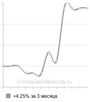 Средняя стоимость МРТ вен головного мозга в Новосибирске