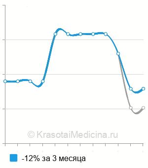 Средняя стоимость анализ на антитела к Scl-70 в Новосибирске