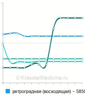 Средняя стоимость цистография в Новосибирске