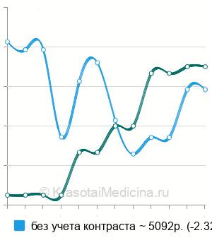Средняя стоимость экскреторная (внутривенная) урография в Новосибирске