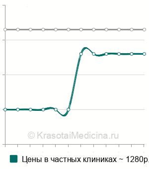 Средняя стоимость обзорная урография в Новосибирске