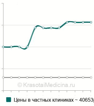 Средняя стоимость артроскопия голеностопного сустава в Новосибирске