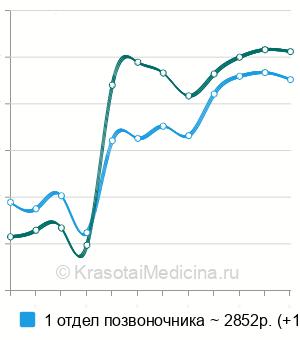 Средняя стоимость мануальная терапия позвоночника в Новосибирске
