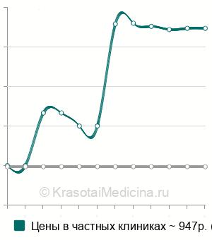 Средняя стоимость криомассаж тела в Новосибирске