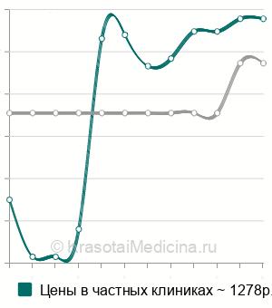 Средняя стоимость эндоскопическая биопсия желудка в Новосибирске