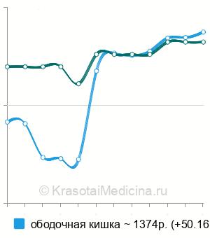Средняя стоимость биопсии толстого кишечника в Новосибирске