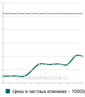 Средняя стоимость сочетанная анестезия в Новосибирске