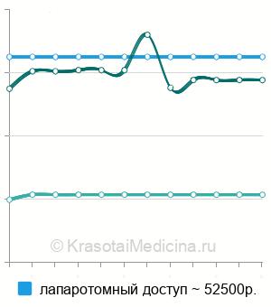 Средняя стоимость гистерэктомия в Новосибирске