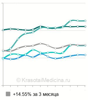 Средняя стоимость МРТ головного мозга в Новосибирске