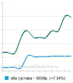 Средняя стоимость МРТ тазобедренного сустава в Новосибирске