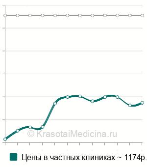 Средняя стоимость удаление инородного тела из гортани в Новосибирске