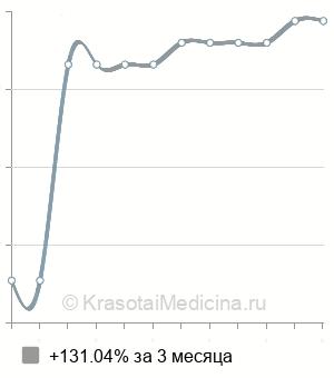 Средняя стоимость инфундибулотомия в Новосибирске