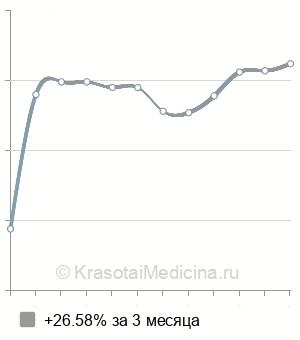 Средняя стоимость ультрафонофорез лекарственных веществ в Новосибирске