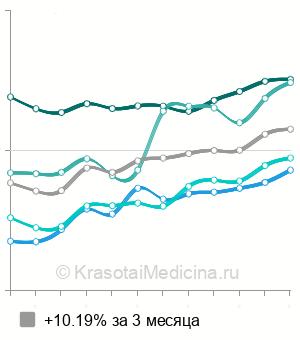 Средняя стоимость УЗИ сосудов головы и шеи в Новосибирске