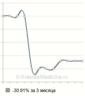 Средняя стоимость удаление стента из мочеточника в Новосибирске